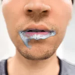 Foaming at the Mouth: Causes and What to Do Right Now Foaming at the Mouth: Causes and What to Do Right Now