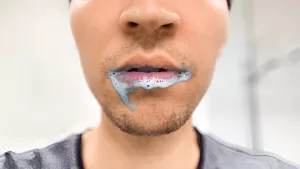 Foaming at the Mouth: Causes and What to Do Right Now