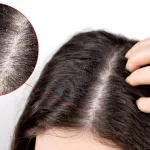 Do Lice Like Dirty Hair? Debunking Myths and Facts Do Lice Like Dirty Hair? Debunking Myths and Facts