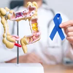 Bowel Cancer and Stomach Noises: What You Need to Know