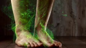 Yellow Feet: Surprising Reasons, Answers and Real Solutions