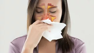 Are Sinus Infections Contagious? Let’s Clear the Air