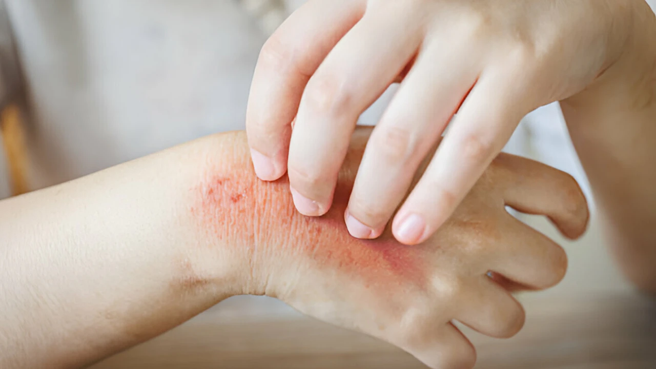 Fleabites 101: What They Look Like & How to Deal