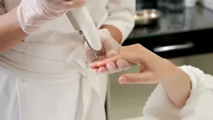 Laser Treatment for Nail Fungus: What to Expect and Cost