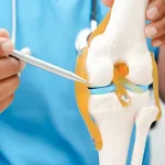 Why Does Pain Occur Behind the Knee After Total Knee Replacement? Why Does Pain Occur Behind the Knee After Total Knee Replacement?