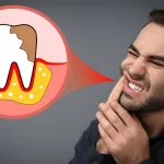 How Much Pain is OK After a Root Canal? Your Guide