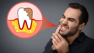 How Much Pain is OK After a Root Canal? Your Guide