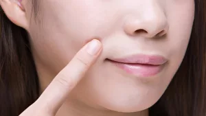 How to Get Rid of Laugh Lines With Exercises Naturally