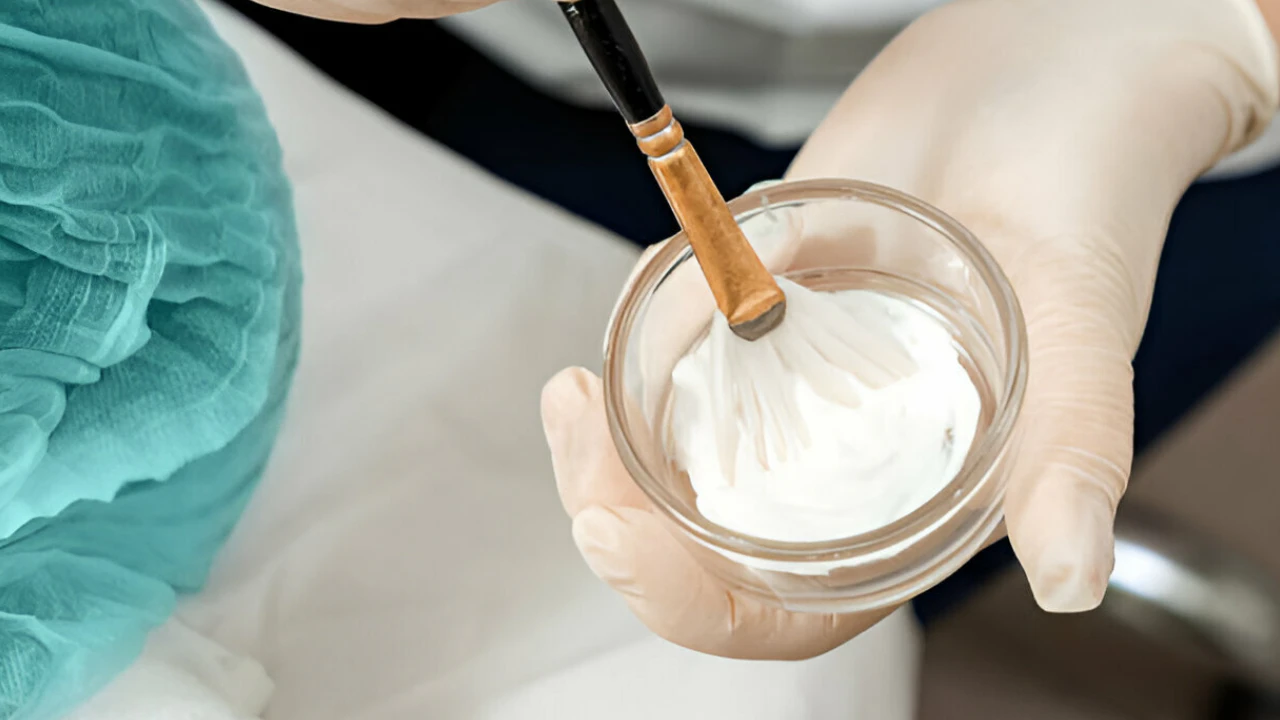 Everything You Need to Know About TCA Chemical Peels