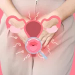 Spotting Symptoms of Vaginal Cuff Tear: What to Know Spotting Symptoms of Vaginal Cuff Tear: What to Know