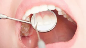 Why Are My Gums Turning White? Causes and Solutions Why Are My Gums Turning White? Causes and Solutions