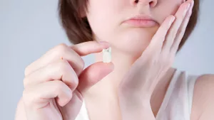 Wisdom Teeth Recovery Timeline: What to Expect After Surgery