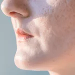 Best Foundations for Acne Scars: Unlock Your Flawless Glow