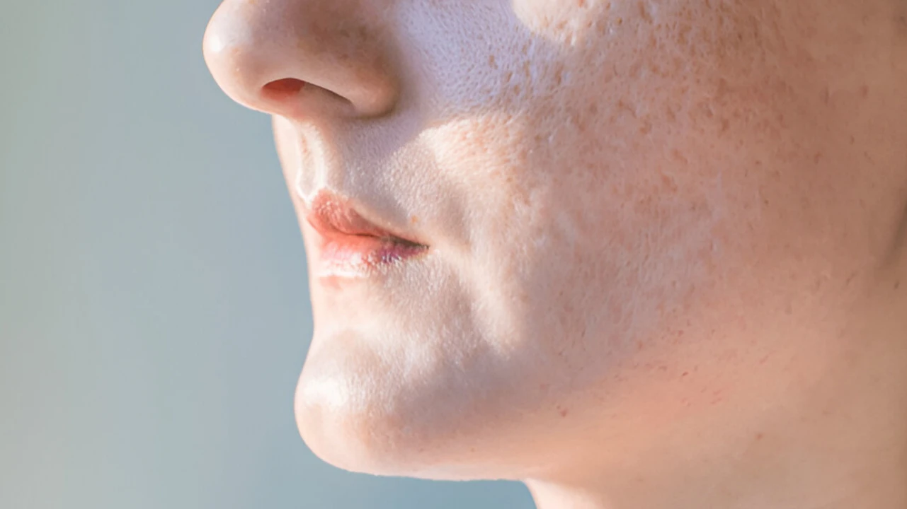 Best Foundations for Acne Scars: Unlock Your Flawless Glow