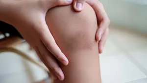 Is It a Blood Clot or Bruise on Your Leg? Find Out Now!