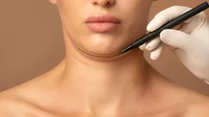 Sculpt Your Profile with a Simple Chin Filler Fix