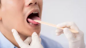 Could Your Throat Pain Be Chlamydia? Find Out Now! Could Your Throat Pain Be Chlamydia? Find Out Now!