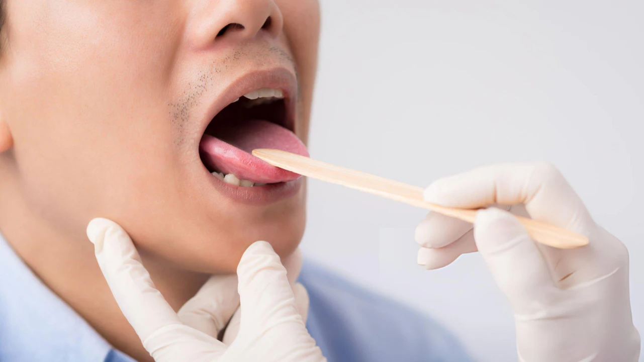 Could Your Throat Pain Be Chlamydia? Find Out Now!