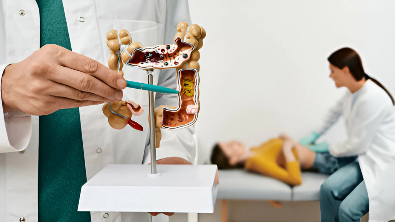 Colon Polyp Size: Know Your Cancer Risk Now