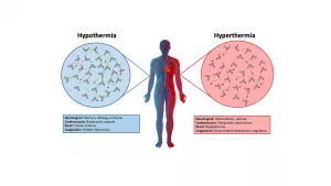 Hyperthermia vs Hypothermia: Discover Key Differences Now!