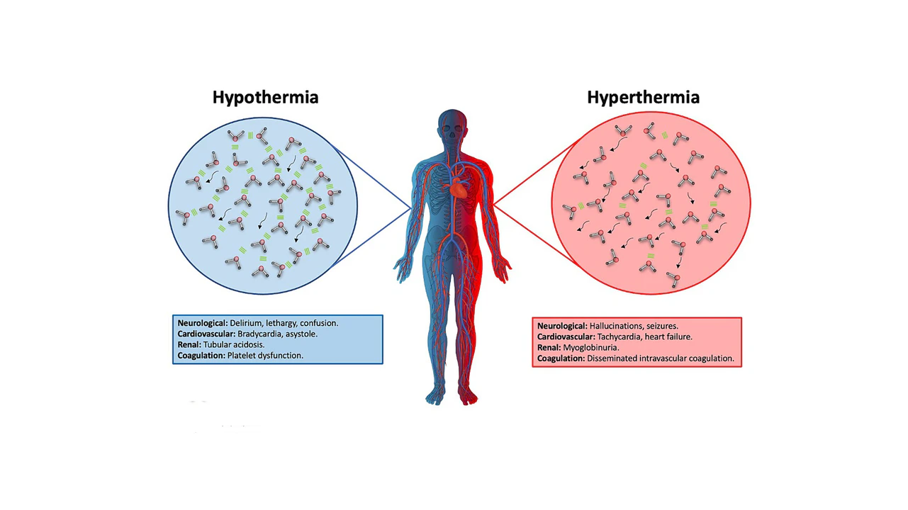 Hyperthermia vs Hypothermia: Discover Key Differences Now!