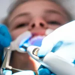 Root Canal Age Secrets: Can Kids Get Them Too?