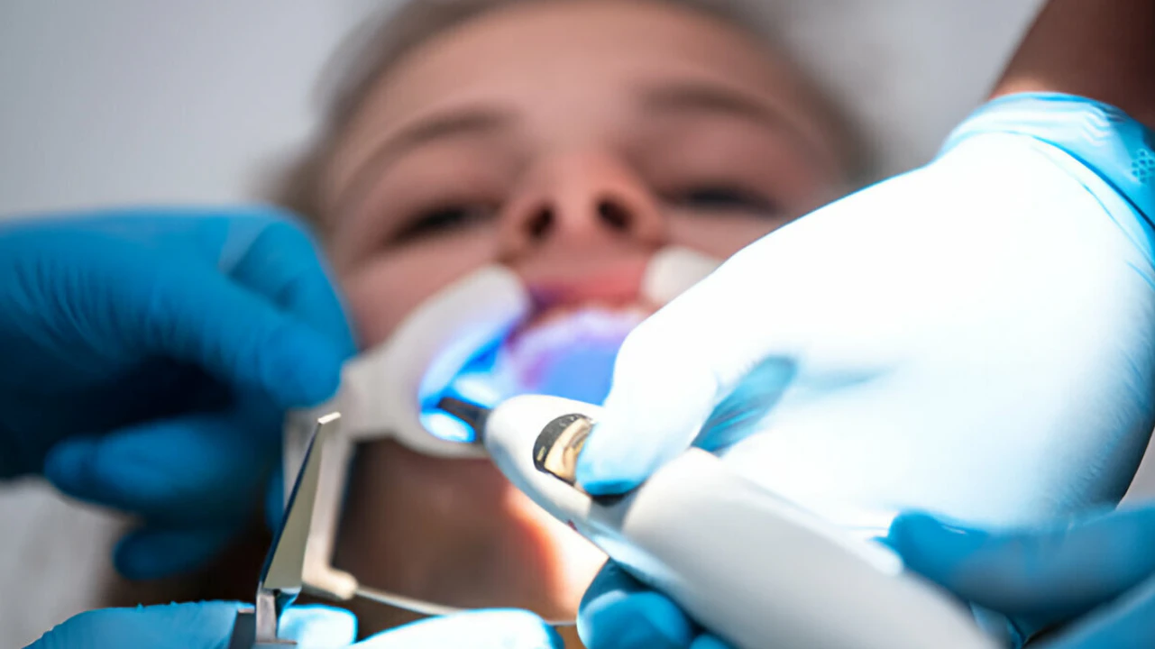 Root Canal Age Secrets: Can Kids Get Them Too?