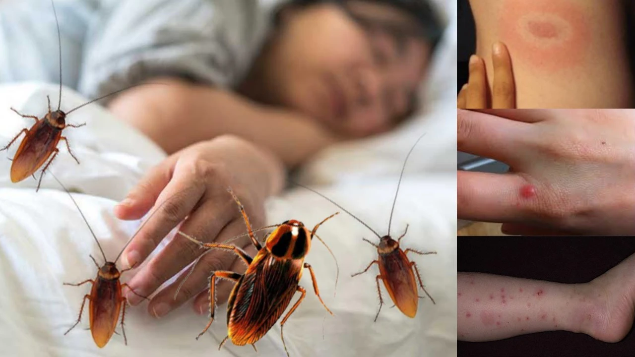 Can Roaches Bite You? The Truth Might Surprise You!