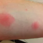 Can Roaches Bite You in Your Sleep? The Surprising Truth Can Roaches Bite You in Your Sleep? The Surprising Truth