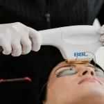How Much Is BBL Laser Treatment? Your Cost Guide Awaits!