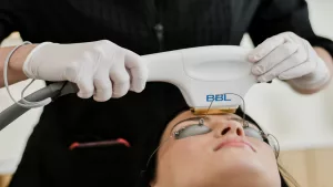 How Much Is BBL Laser Treatment? Your Cost Guide Awaits!