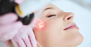 Laser for Dark Spots: What You Should Know