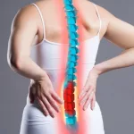 What Benefits Can I Claim With Spinal Stenosis? Your Answers What Benefits Can I Claim With Spinal Stenosis? Your Answers