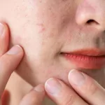 How To Select the Best Serums for Textured Skin: Your Guide