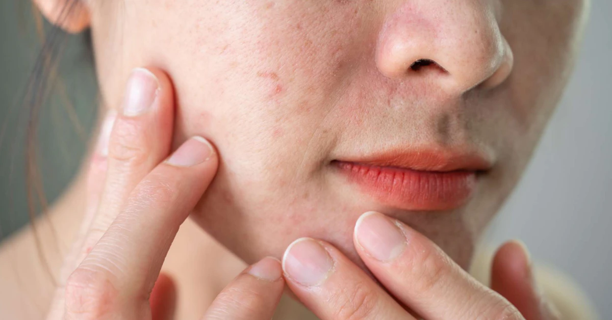How To Select the Best Serums for Textured Skin: Your Guide