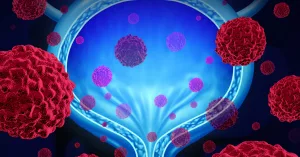 New Discovery Boosts Bladder Cancer Immunotherapy (And Why It Matters)