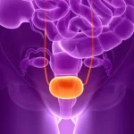 Urine-Based Test Helps Personalize Bladder Cancer Treatment