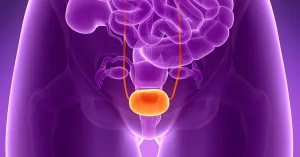 Urine-Based Test Helps Personalize Bladder Cancer Treatment