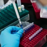 Blood Test for Autism Gene: What Every Family Should Know