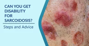 Can You Get Disability for Sarcoidosis? Steps and Advice