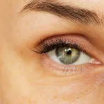 Dissolve Under Eye Filler: What You Need to Know Dissolve Under Eye Filler: What You Need to Know