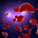 Gene Therapy for Sickle Cell: Cutting Stroke Risk, One Cell At a Time Gene Therapy for Sickle Cell: Cutting Stroke Risk, One Cell At a Time