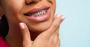 How Much Are Braces in CT? What You Need to Know