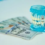 Comprehensive Guide: How Much Are Braces in Hawaii?