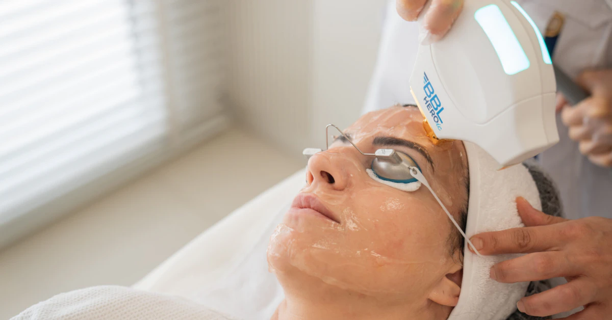 How Much Is a BBL Laser Treatment? Get Exact Price Now
