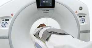 Lung Cancer Screening Is Starting—What Smokers or Ex-Smokers Need