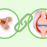 Malnutrition and Osteoarthritis: The Hidden Connection Malnutrition and Osteoarthritis: The Hidden Connection