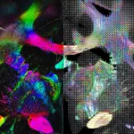 Advanced Tools for Nerve Fiber Imaging in the Brain