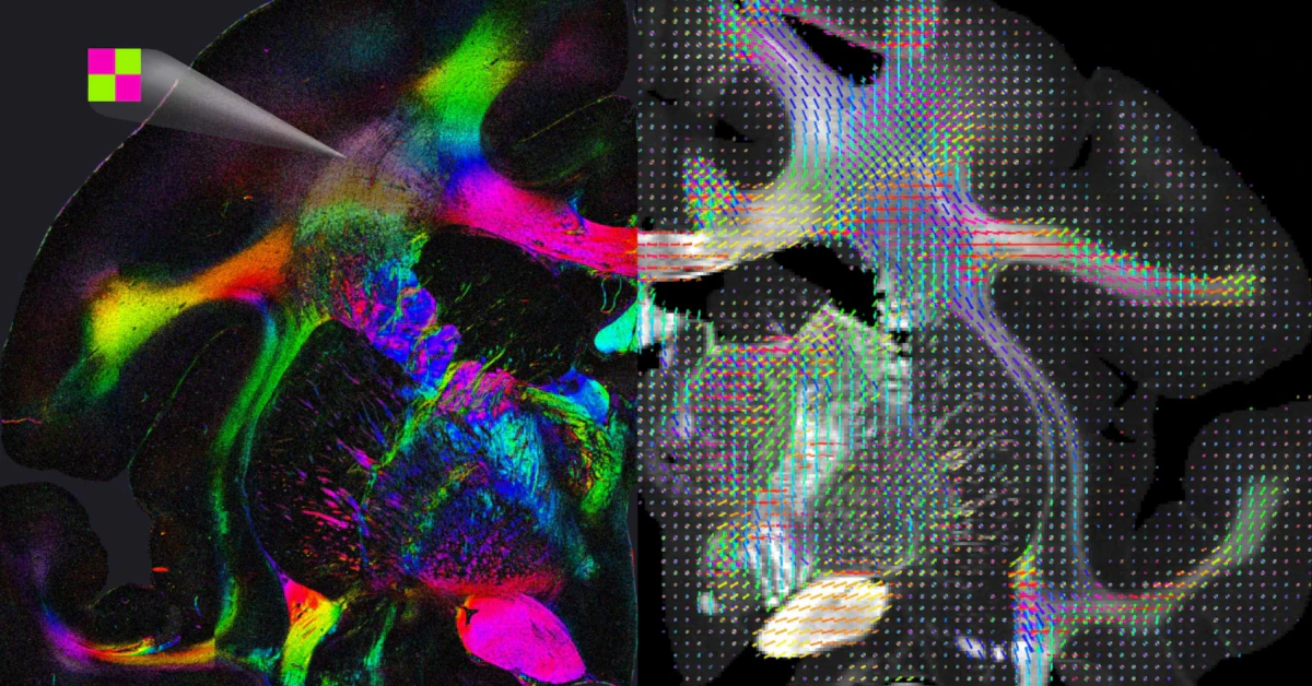 Advanced Tools for Nerve Fiber Imaging in the Brain