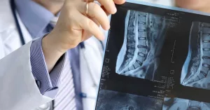 Sciatica Orthopedic or Neurologist: End Pain Now